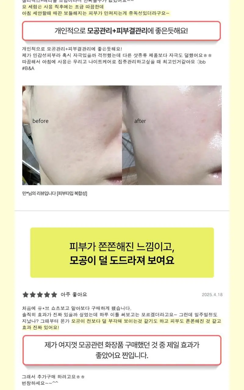 [모공/탄력/결] 셀리맥스 더 비타 A 레티놀 샷 타이트닝 세럼 30ml 상세페이지 12